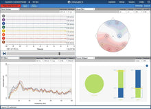 画像をギャラリービューアに読み込む, OpenBCI Ganglion 集録ボード(4チャンネル)