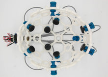 画像をギャラリービューアに読み込む, ThinkPulseアクティブ電極