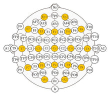 画像をギャラリービューアに読み込む, EEGキャップ